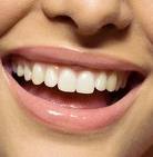 istanbul, kadıköy, moda, diş, diş hekimi, dişçi, diş doktoru, diş hastanesi, diş kliniği, randevu, ağız sağlığı, diş sağlığı, ağız ve diş sağlığı, diş tedavisi, porselen diş, diş kaplama, kaplama diş, lamina diş, lamine diş, diş beyazlatma, diş parlatma, implant diş, takma diş, gülüş estetiği, diş estetiği, dolgu diş, diş dolgusu, diş eti çekilmesi, diş eti kanaması, diş eti iltihabı, diş iltihabı, diş apse, diş eti tedavisi, kanal tedavisi, çocuk diş, süt dişleri, süt dişi, ortodonti, diş teli, diş protez, protez diş, zirkonyum diş, çene cerrahisi, diş muayene, diş bakımı, diş lekeleri, kırık diş, diş kırıkları, aralık dişler, çarpık diş, diş taşı temizliği, diş taşı temizleme, tartar temizliği, tartar temizleme, diş gıcırdatma, diş çürüğü, köprü diş, azı dişi, çürük diş, diş ağrısı, köpek dişi