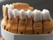 istanbul, kadıköy, moda, diş, diş hekimi, dişçi, diş doktoru, diş hastanesi, diş kliniği, randevu, ağız sağlığı, diş sağlığı, ağız ve diş sağlığı, diş tedavisi, porselen diş, diş kaplama, kaplama diş, lamina diş, lamine diş, diş beyazlatma, diş parlatma, implant diş, takma diş, gülüş estetiği, diş estetiği, dolgu diş, diş dolgusu, diş eti çekilmesi, diş eti kanaması, diş eti iltihabı, diş iltihabı, diş apse, diş eti tedavisi, kanal tedavisi, çocuk diş, süt dişleri, süt dişi, ortodonti, diş teli, diş protez, protez diş, zirkonyum diş, çene cerrahisi, diş muayene, diş bakımı, diş lekeleri, kırık diş, diş kırıkları, aralık dişler, çarpık diş, diş taşı temizliği, diş taşı temizleme, tartar temizliği, tartar temizleme, diş gıcırdatma, diş çürüğü, köprü diş, azı dişi, çürük diş, diş ağrısı, köpek dişi