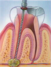 istanbul, kadıköy, moda, diş, diş hekimi, dişçi, diş doktoru, diş hastanesi, diş kliniği, randevu, ağız sağlığı, diş sağlığı, ağız ve diş sağlığı, diş tedavisi, porselen diş, diş kaplama, kaplama diş, lamina diş, lamine diş, diş beyazlatma, diş parlatma, implant diş, takma diş, gülüş estetiği, diş estetiği, dolgu diş, diş dolgusu, diş eti çekilmesi, diş eti kanaması, diş eti iltihabı, diş iltihabı, diş apse, diş eti tedavisi, kanal tedavisi, çocuk diş, süt dişleri, süt dişi, ortodonti, diş teli, diş protez, protez diş, zirkonyum diş, çene cerrahisi, diş muayene, diş bakımı, diş lekeleri, kırık diş, diş kırıkları, aralık dişler, çarpık diş, diş taşı temizliği, diş taşı temizleme, tartar temizliği, tartar temizleme, diş gıcırdatma, diş çürüğü, köprü diş, azı dişi, çürük diş, diş ağrısı, köpek dişi